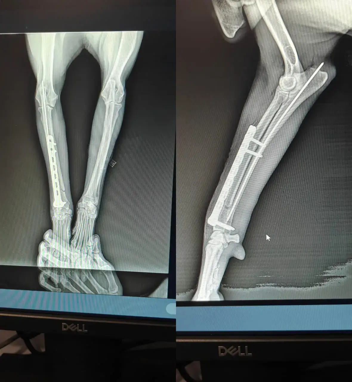 Distal Radius–Ulna Fracture Repair in a Dog 