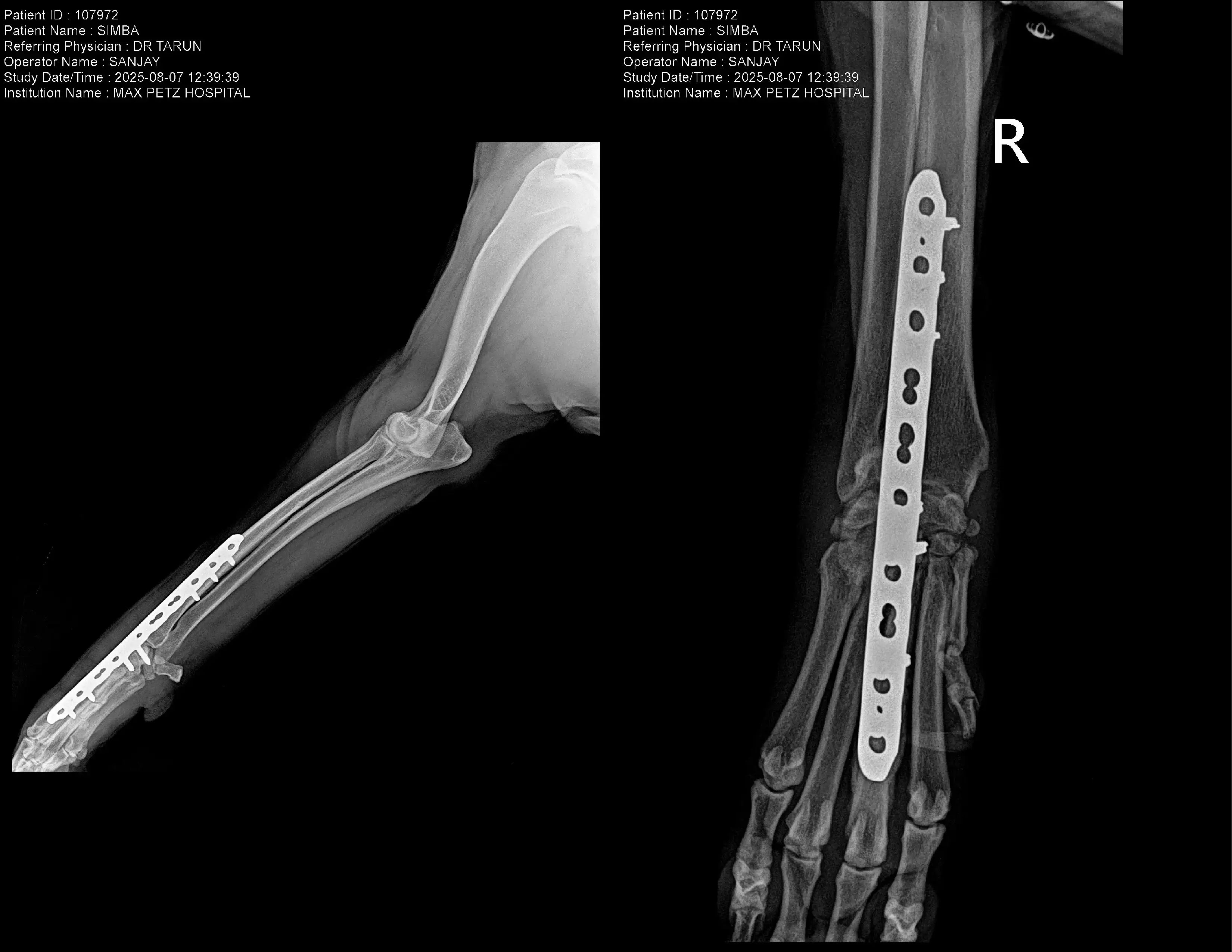 Pancarpal Arthrodesis for Carpal Instability X Ray for Dogs