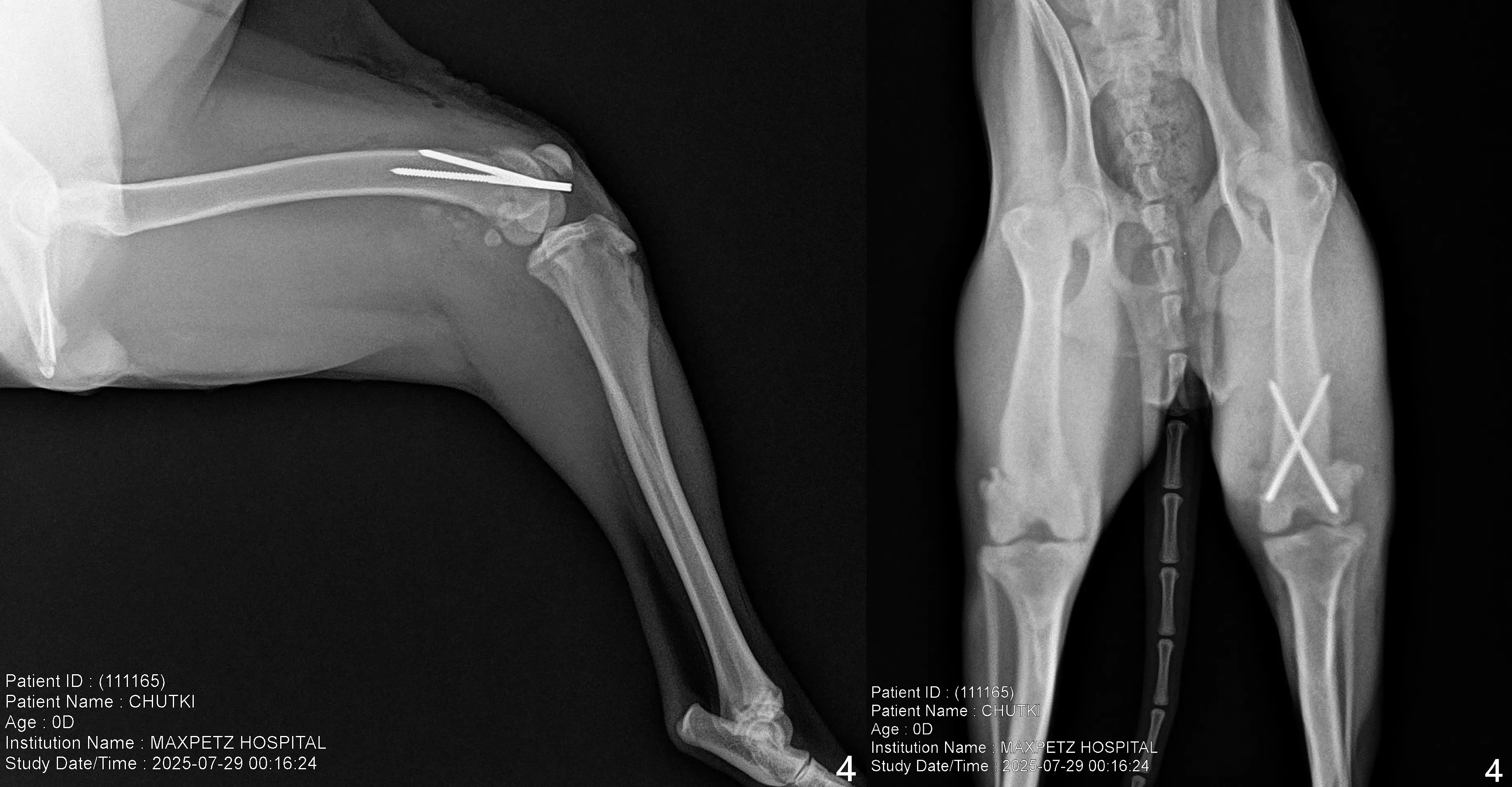 X ray Distal Femur Fracture Repair in a Juvenile Dog 